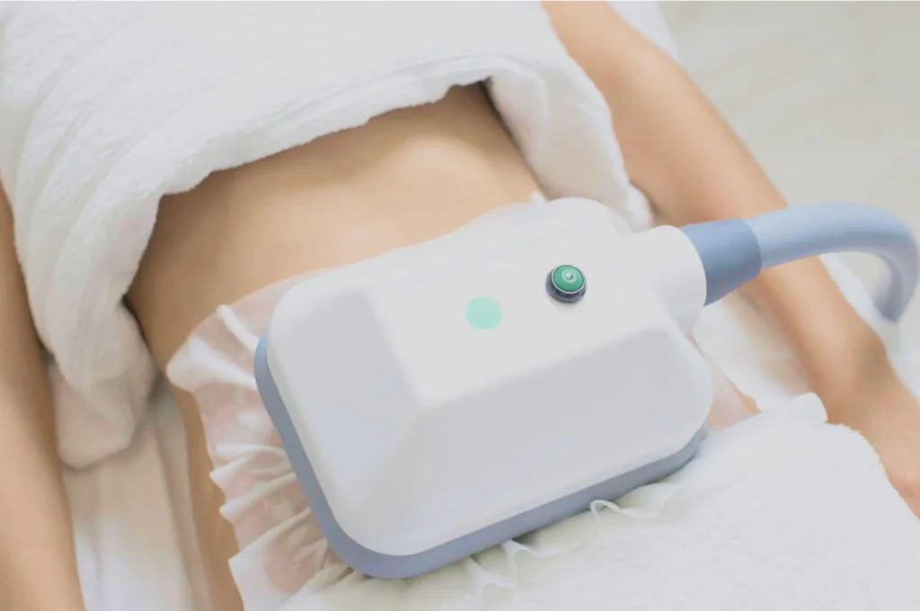 How Fat Freezing and HIFU Work Together? 3 advantages to combining Fat Freezing and HIFU Bridport