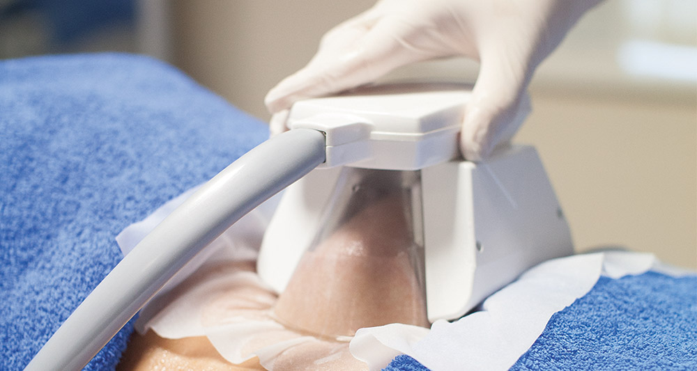 How Fat Freezing and HIFU Work Together? 2 Multiple Areas in One Session HIFU and Fat Freezing Bridport
