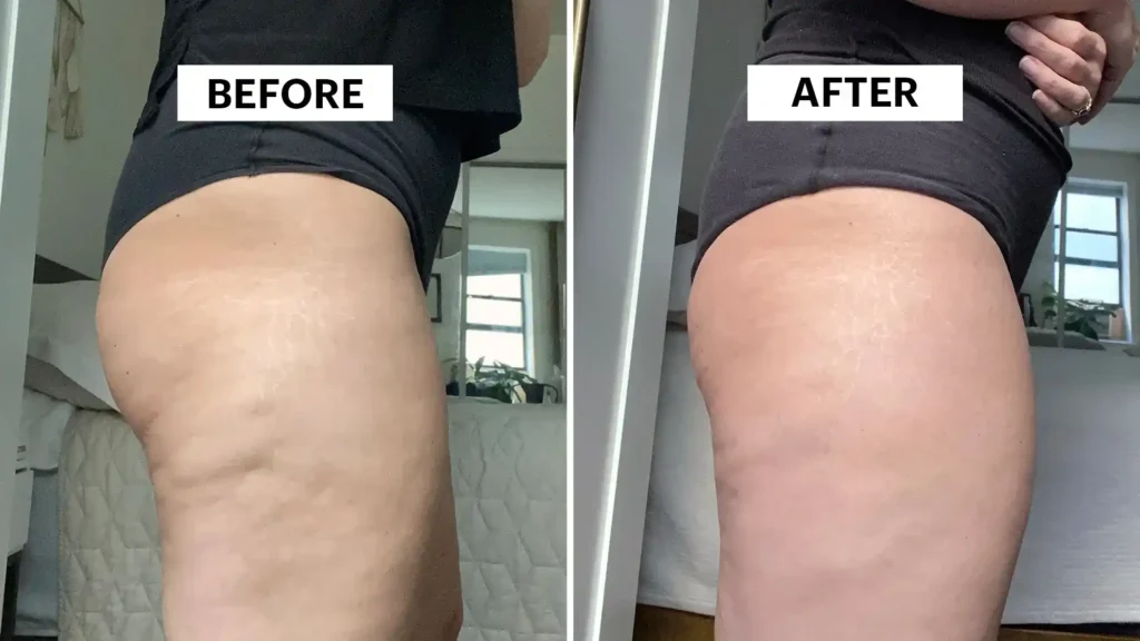 Do Toning Exercise Bridport Really Tackle Cellulite?