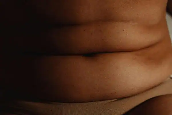 The Hidden Connection: How Stress Shapes Your Fitness and Body Composition 3 image of what stress can do on the stomach area and how Lipo 360 Bridport can help to change your body shape.