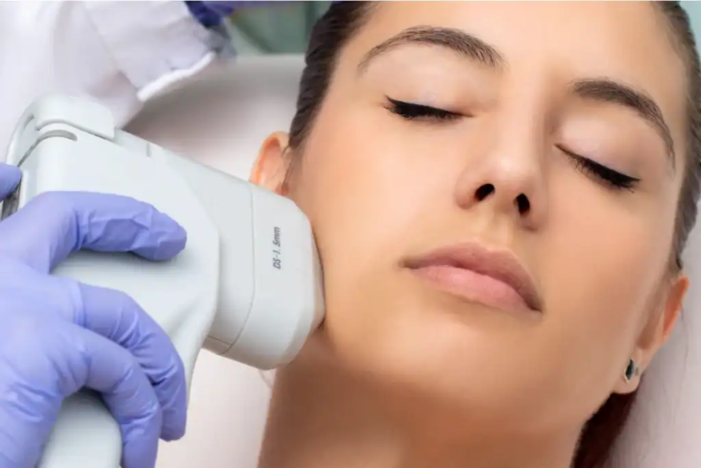 Discover the Perfect Duo: RF Microneedling and HIFU 2 Image of Morpheus8 And HIFU Combined with Lipo 360 Bridport
