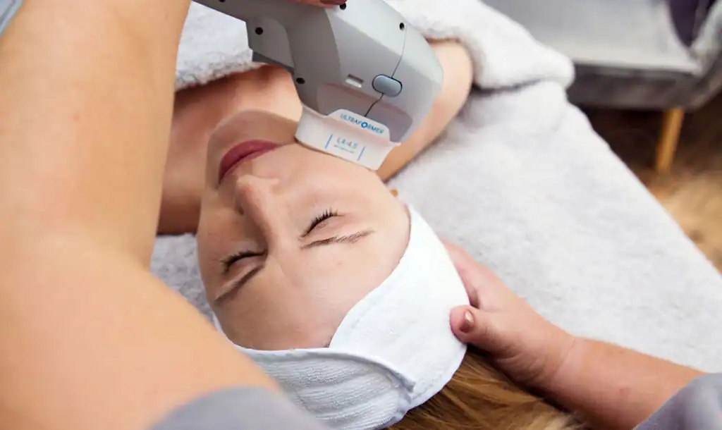 Discover the Perfect Duo: RF Microneedling and HIFU 1 Image of Morpheus8 And HIFU Bridport combined treatment